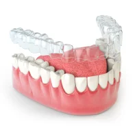 pic-3d-invisalign